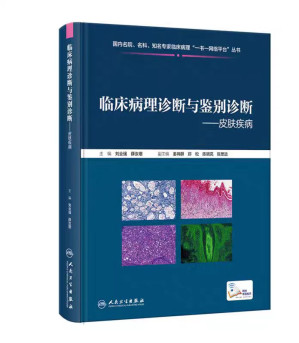[PDF] 临床病理诊断与鉴别诊断 皮肤疾病