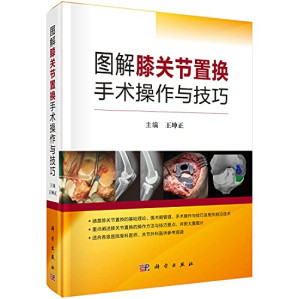 [PDF] 图解膝关节置换手术操作与技巧