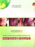 [PDF] 麻风病诊断与鉴别诊断图谱