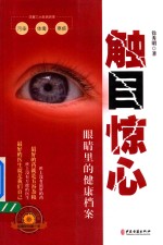 [PDF] 触目惊心 眼睛里的健康档案