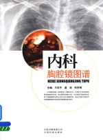 [PDF] 内科胸腔镜图谱