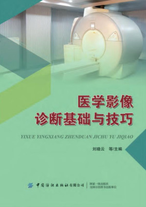 [EPUB] 医学影像诊断基础与技巧