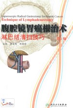 [PDF] 腹腔镜胃癌根治术淋巴结清扫技巧